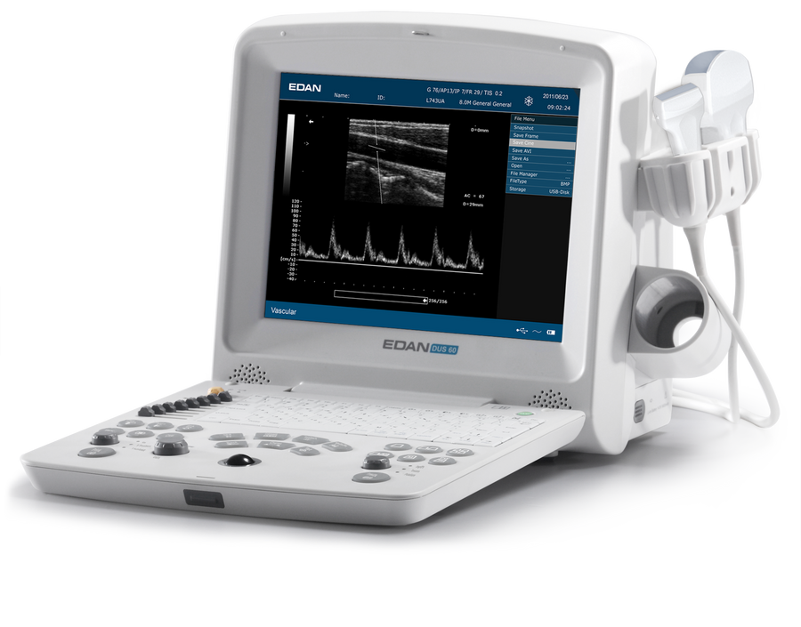 DUS 60 Ultrasound System