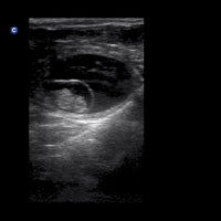 Chison ECO1Vet Equine Bovine Small Animal Ultrasound Machine | Veterinary Ultrasounds