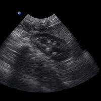 Chison ECO1Vet Equine Bovine Small Animal Ultrasound Machine | Veterinary Ultrasounds