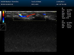 DCU30Vet Color Doppler Ultrasound | Veterinary Ultrasounds