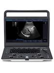 SonoScape A6V Expert-E1V | Veterinary Ultrasounds