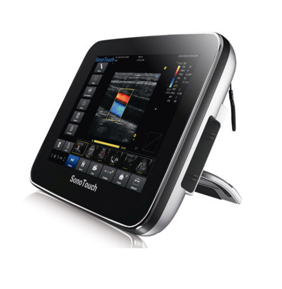 Chison SonoTouch 30Vet - Deals on Veterinary Ultrasounds
 - 1