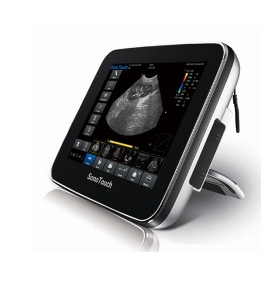 Chison SonoTouch 20Vet - Deals on Veterinary Ultrasounds
