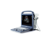 Used Sonoscape S2V Ultrasound - Deals on Veterinary Ultrasounds
 - 1