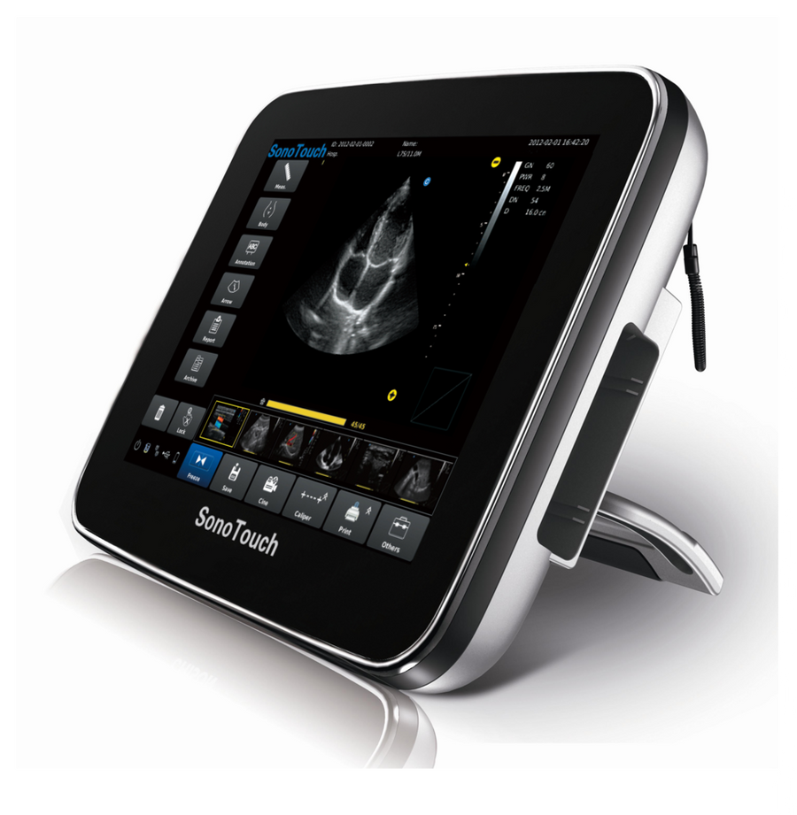 Chison SonoTouch 10Vet - Deals on Veterinary Ultrasounds