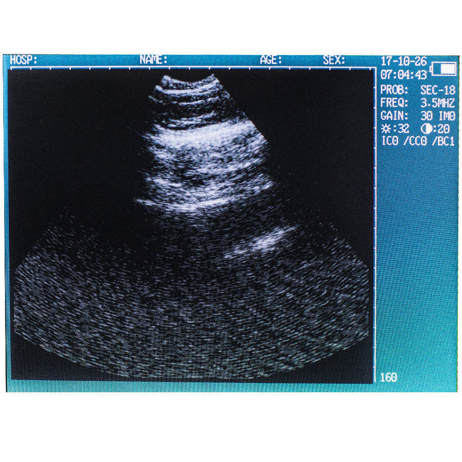 Handheld Veterinary Ultrasound Scanner Rectal Probe Pregnancy US Seller Fast 190891468284