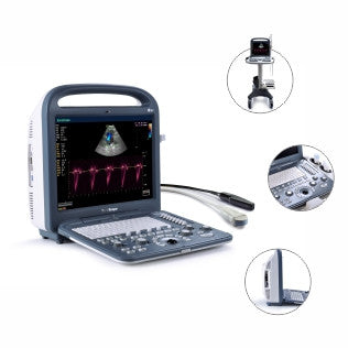 SonoScape S2V Ultrasound - Deals on Veterinary Ultrasounds
 - 3